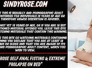 Sindy Rose self anal fisting &amp; extreme prolapse on bed