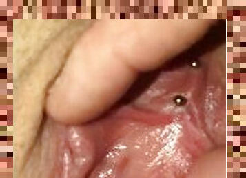 NSFW Pimple Popping On Her Labia Minora