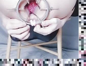 EXTREME GAPE PROLAPSE SPECULUM LOOK INSIDE SISSY